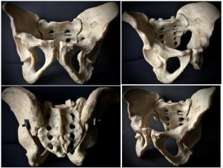 Vintage Anatomical Model Of A Human Pelvis Pelvic Bone Resin Curiosity Oddities