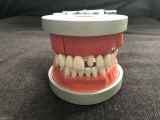 Vintage Acadental Modupro Dental Teeth Dentistry Mold Model Typodont 1