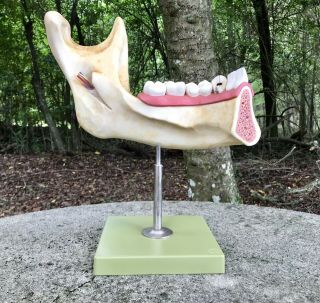 Vintage Dental Model,  Anatomical Model Of Teeth,  Gums,  Jaw