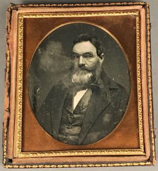 1/6 Plate Daguerreotype Of Great Bearded Gent,  Issues,  Half Case