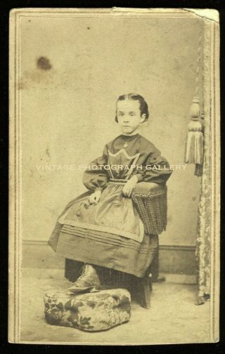 Antique Cdv Photo Girl With One Leg Medical Oddity Amputee Hackettstown Nj