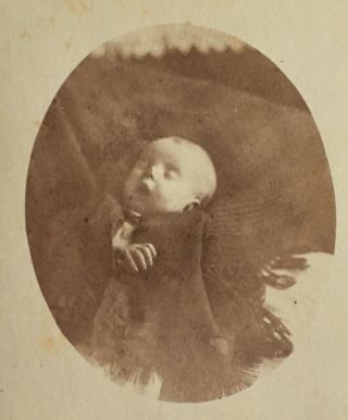 Cdv Post Mortem Photo Of Young Child Wrapped In Black Shawl