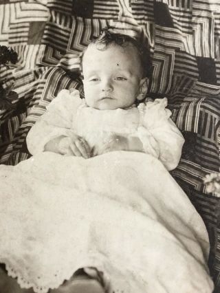 Post Mortem Baby Child With Open Eyes