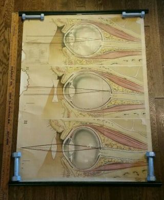 1940 Vintage Medical Eye Pull Down Wall Chart - Rudolph Schick - Clay Adams Co.