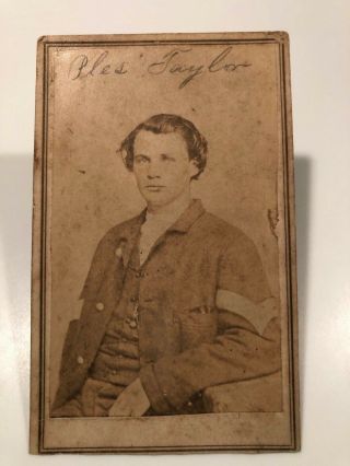 Civil War Soldier Identified Cdv Photograph 31st Illinois Infantry (wia)