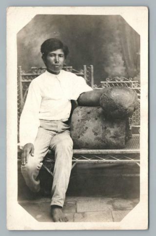 Boy W Elephantiasis Hand Rppc Antique Medical Oddity Deformity Photo 1910s