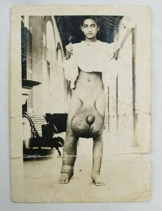 WWII 1940s GI ' s South Pacific Photo Philippine Fiji Elephantiasis Genital Oddity 2