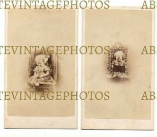 Old Cdv Photos Dead Child Post Mortem Image F Hudson Ventnor Isle Of Wight 1860s