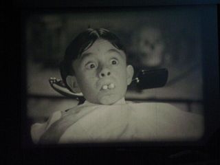 The Little Rascals (1938) - The Awful Tooth - 16mm Film