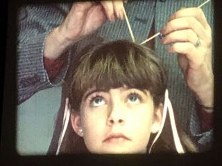 16mm Film Head Lice - Instructional Film On How To Avoid And Destroy Lice