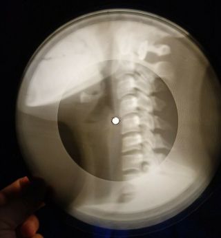 Beatles - And I Love Her X - Ray Of The Ussr Recording X - Ray Bone