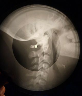 Simon & Garfunkel - Homeward Bound X - Ray Of The Ussr X - Ray Bone Record