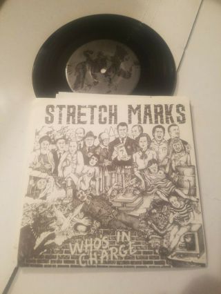 Stretch Marks Who 