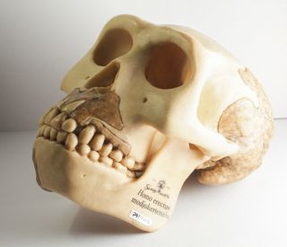 Rare Somso Homo Erectus Modjoketensis Skull Anatomical Model Anatomy Vintage