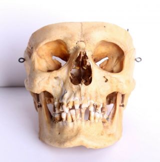 Antique Medical Skull Illustrative