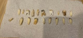 Human Teeth For Dental Research Studied 18,  Art Halloween Collectibles