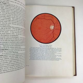 Vintage Medical Book Anatomy Of The Eye And The Orbit Illustrations 1944