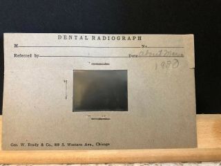 Vintage 1930 Dental Radiograph X - Ray Film Gen W.  Brady & Ci Chicago Ill