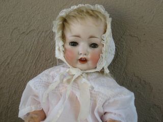 Antique German Koenig & Wernicke Character Baby Doll 99 Bisque Head Rare L2