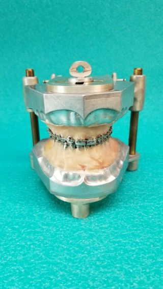 Rare Metal Orthodontists Columbia Dentoform Dental Training Trainer Teeth Model